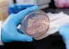 Cảm biến sinh học dựa vào Vi khuẩn để phát hiện bệnh thiếu kẽm